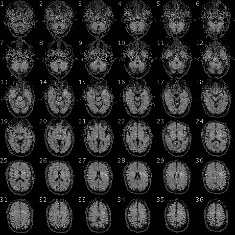 Sample fMRI scan of the human brain