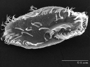 Microscope image of unicellular Oxytricha trifallax