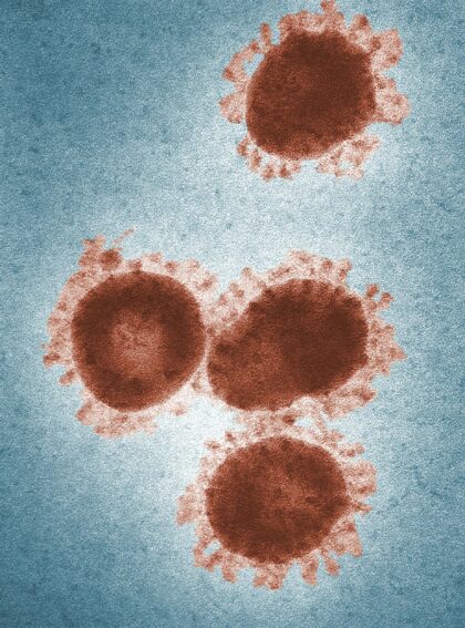 false color micrograph of measles virus